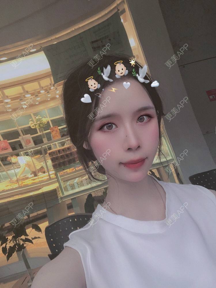 更美 - 超级超级好吃的下巴经验 | 膨体垫下巴 | 宽下巴矫正 | 人工骨垫下巴 | 双下巴溶脂 | 胶原蛋白丰下巴 | 下巴