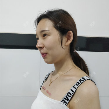 十雾亿