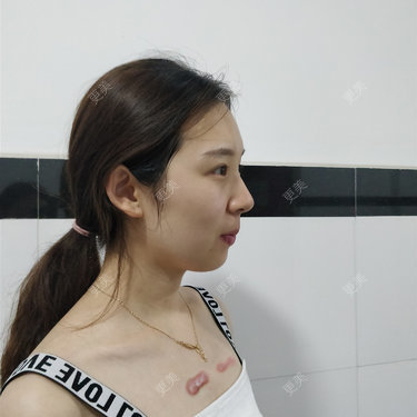 十雾亿
