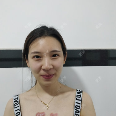 十雾亿