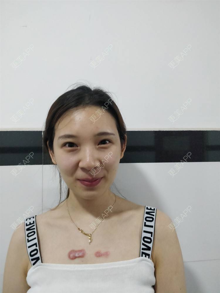 更美 - 十雾亿的综合淡疤经验 | 综合淡疤 | 北京