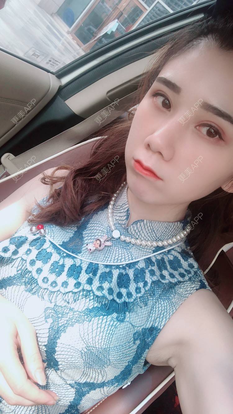 更美 - 半个柚子不加C的鼻部多项经验 | 自体肋软骨垫鼻基底 | 假体垫鼻基底 | 自体脂肪垫鼻基底 | 玻尿酸鼻基底 | 鼻中隔软骨垫鼻头 | 鼻基底