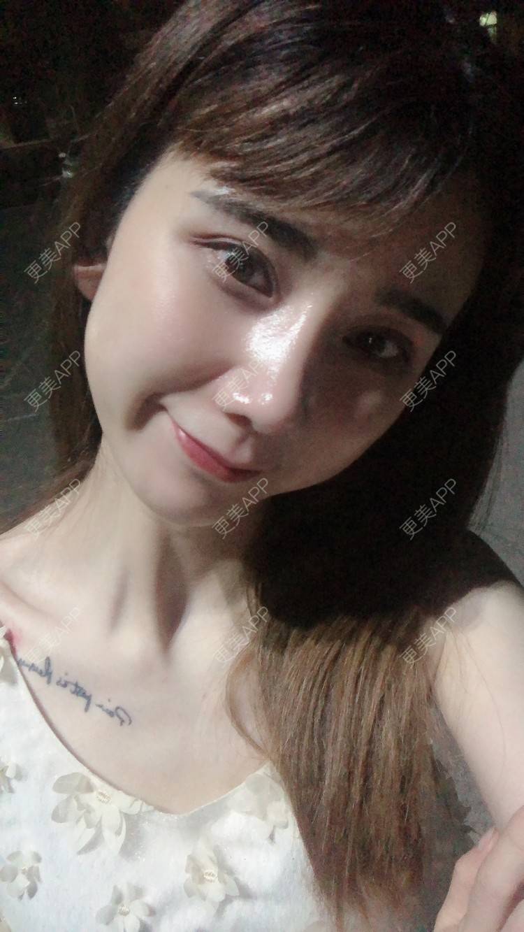 更美 - 半个柚子不加C的鼻部多项经验 | 自体肋软骨垫鼻基底 | 假体垫鼻基底 | 自体脂肪垫鼻基底 | 玻尿酸鼻基底 | 鼻中隔软骨垫鼻头 | 鼻基底