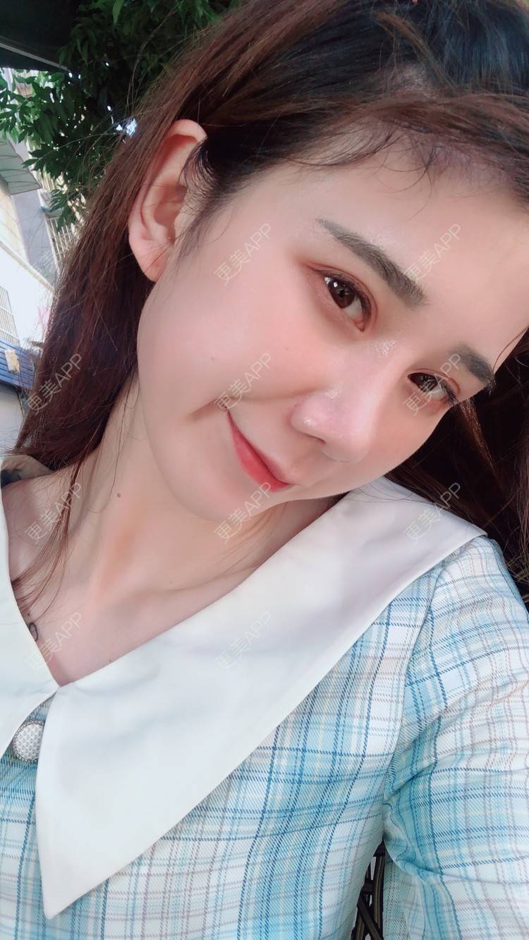 更美 - 半个柚子不加C的鼻部多项经验 | 自体肋软骨垫鼻基底 | 假体垫鼻基底 | 自体脂肪垫鼻基底 | 玻尿酸鼻基底 | 鼻中隔软骨垫鼻头 | 鼻基底