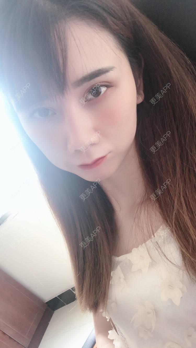 更美 - 半个柚子不加C的鼻部多项经验 | 自体肋软骨垫鼻基底 | 假体垫鼻基底 | 自体脂肪垫鼻基底 | 玻尿酸鼻基底 | 鼻中隔软骨垫鼻头 | 鼻基底