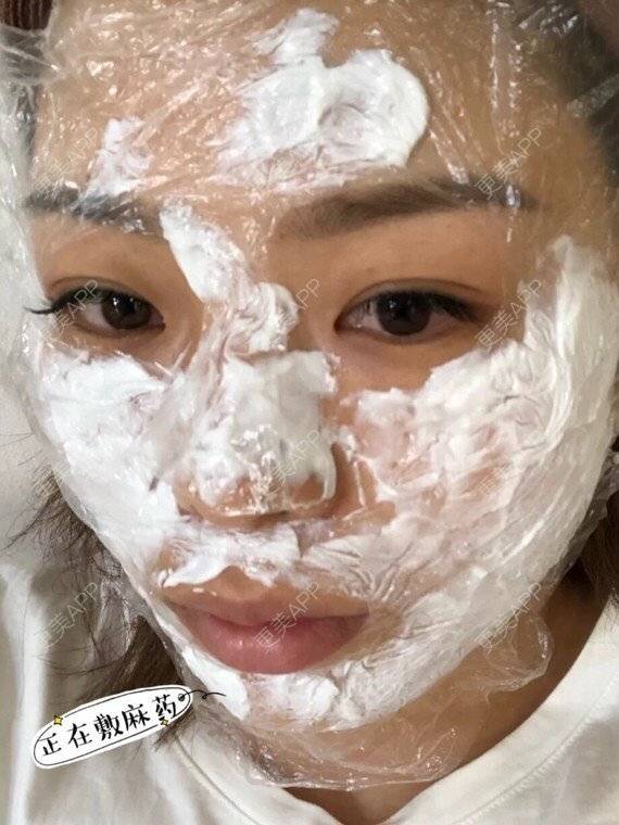 更美 - 更美用户DrgBVKI7yN的皮秒激光经验 | 皮秒激光 | 上海