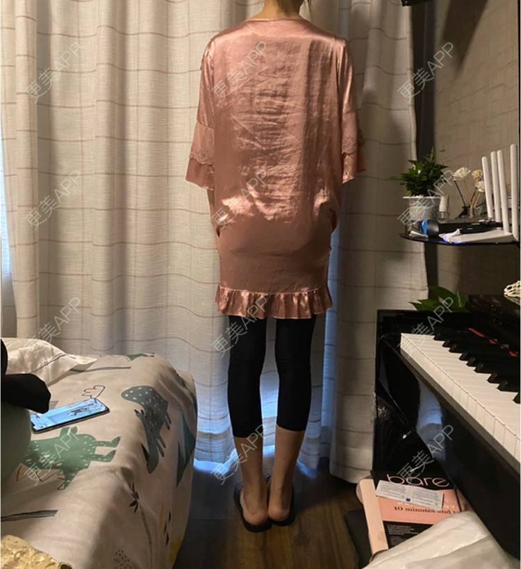 更美 - 玉琼#的自体脂肪丰臀经验 | 自体脂肪丰臀 | 上海 | 自体脂肪身体塑形