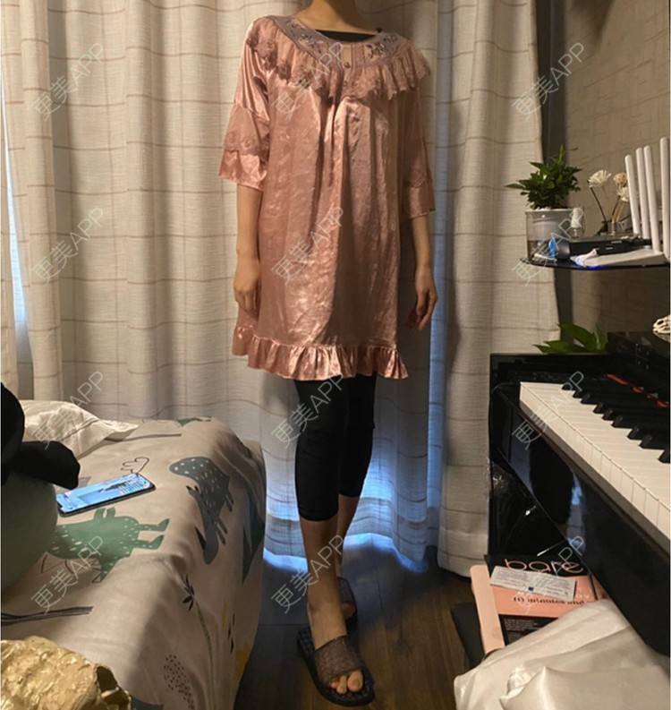 更美 - 玉琼#的自体脂肪丰臀经验 | 自体脂肪丰臀 | 上海 | 自体脂肪身体塑形