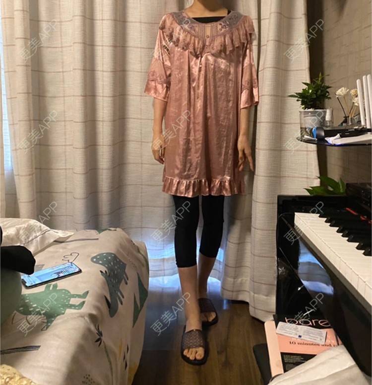 更美 - 玉琼#的自体脂肪丰臀经验 | 自体脂肪丰臀 | 上海 | 自体脂肪身体塑形