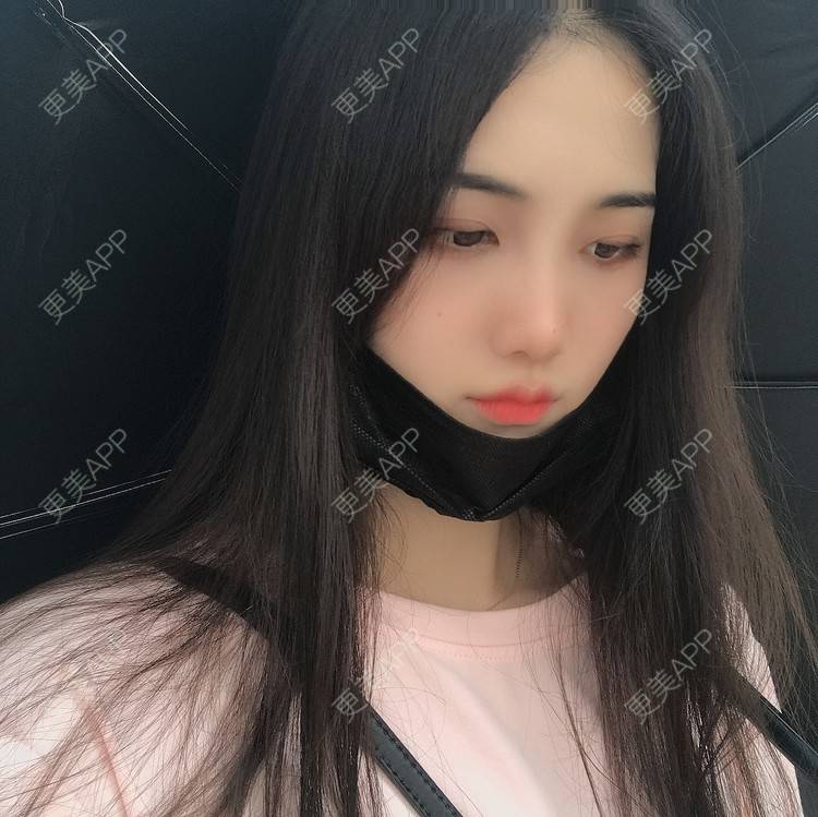 更美 - •你的小可爱•的面部脱毛经验 | 面部脱毛 | 玻尿酸泪沟 | 玻尿酸鼻部 | 玻尿酸下巴 | 深圳