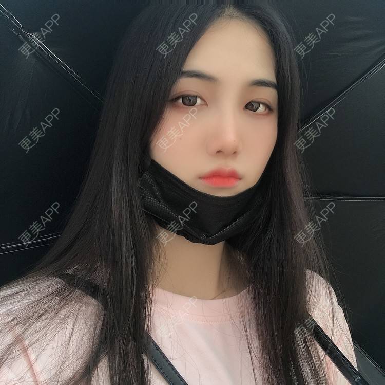 更美 - •你的小可爱•的面部脱毛经验 | 面部脱毛 | 玻尿酸泪沟 | 玻尿酸鼻部 | 玻尿酸下巴 | 深圳