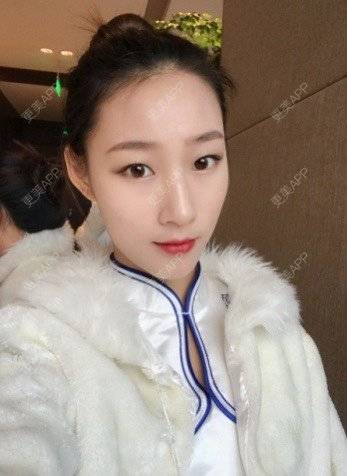 更美 - 苏州维多利亚整形美容医院的眼部多项经验 | 苏州 | 眼部多项