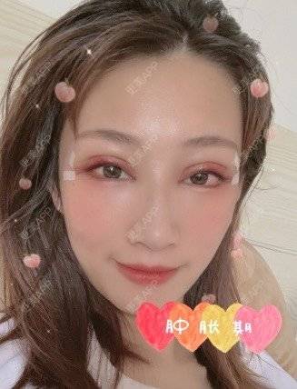 更美 - 苏州维多利亚整形美容医院的眼部多项经验 | 苏州 | 眼部多项