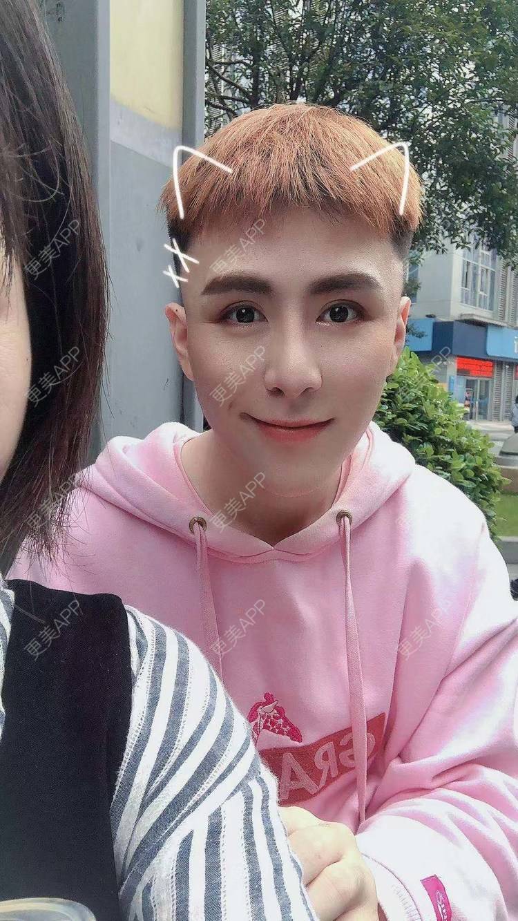 更美 - 陈温柔~的膨体垫眉弓经验 | 重庆 | 膨体垫眉弓 | 视频日记