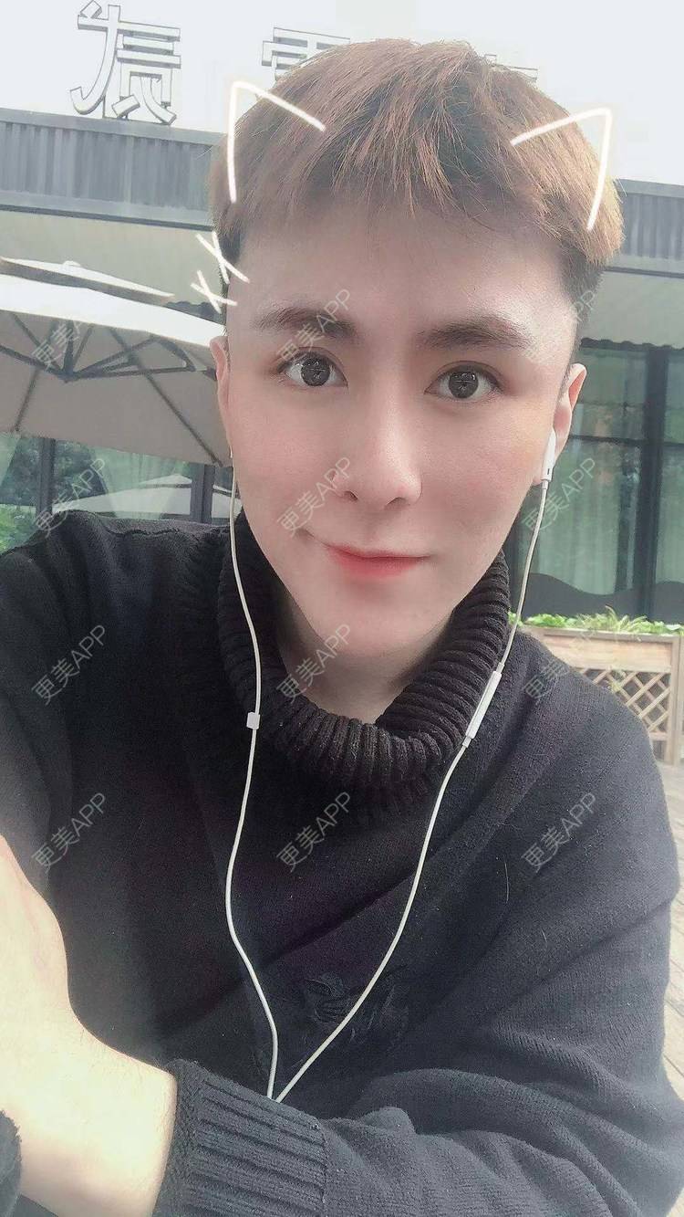 更美 - 陈温柔~的膨体垫眉弓经验 | 重庆 | 膨体垫眉弓 | 视频日记