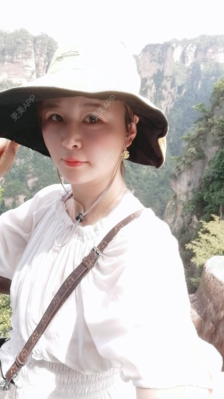更美 - 爱折腾的小姐姐的射频去眼袋经验 | 西安 | 射频去眼袋