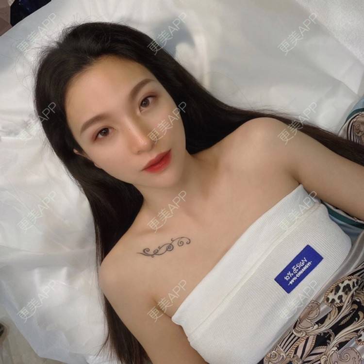 更美 - 更美用户bIx2gkwc44的半永久纹眼线经验 | 北京 | 半永久纹眼线