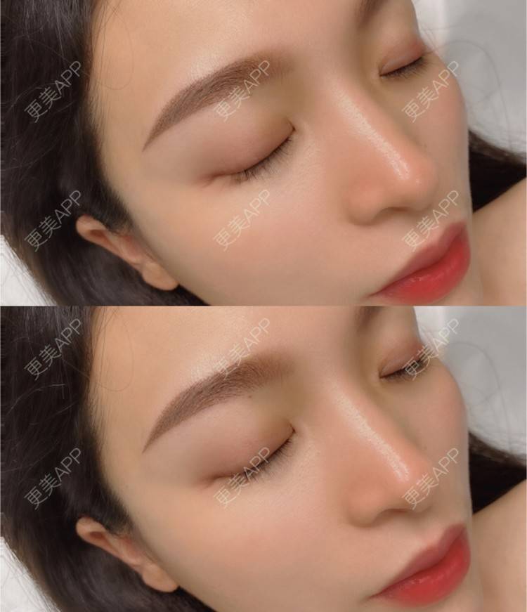 更美 - 更美用户bIx2gkwc44的半永久纹眼线经验 | 北京 | 半永久纹眼线
