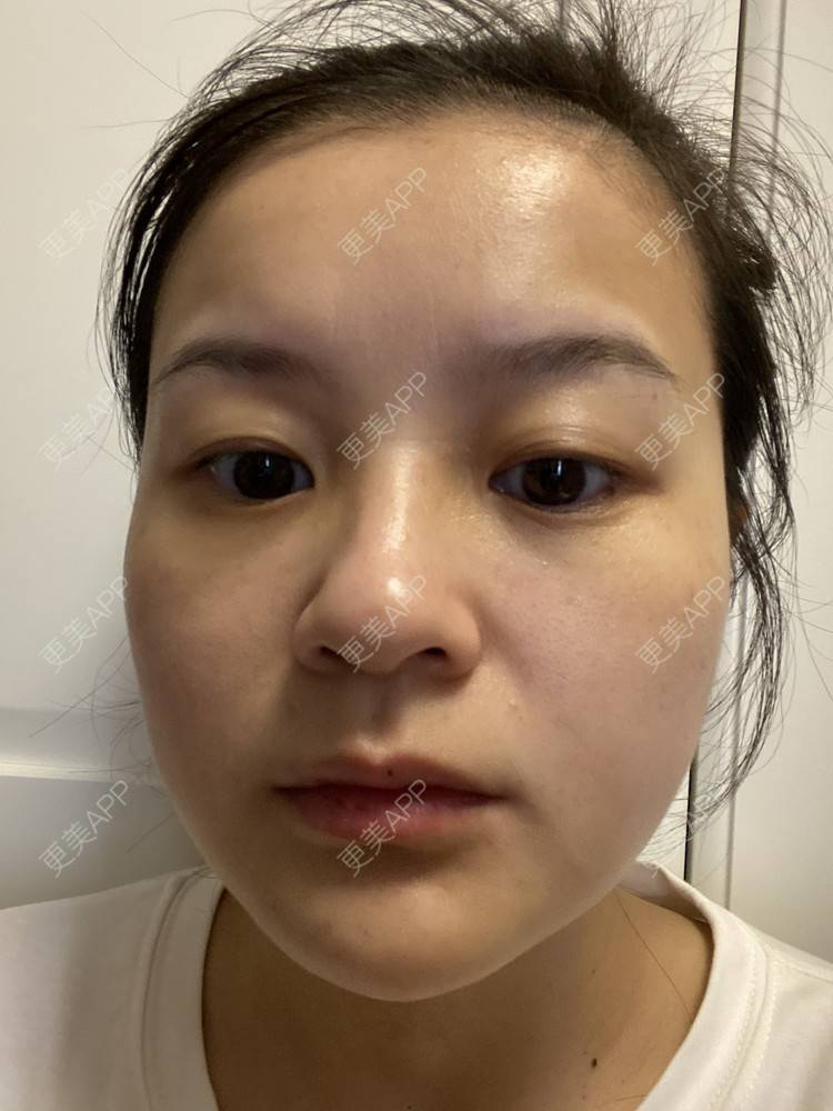 更美 - 一白遮三丑丑丑的热拉提经验 | 上海 | 热拉提