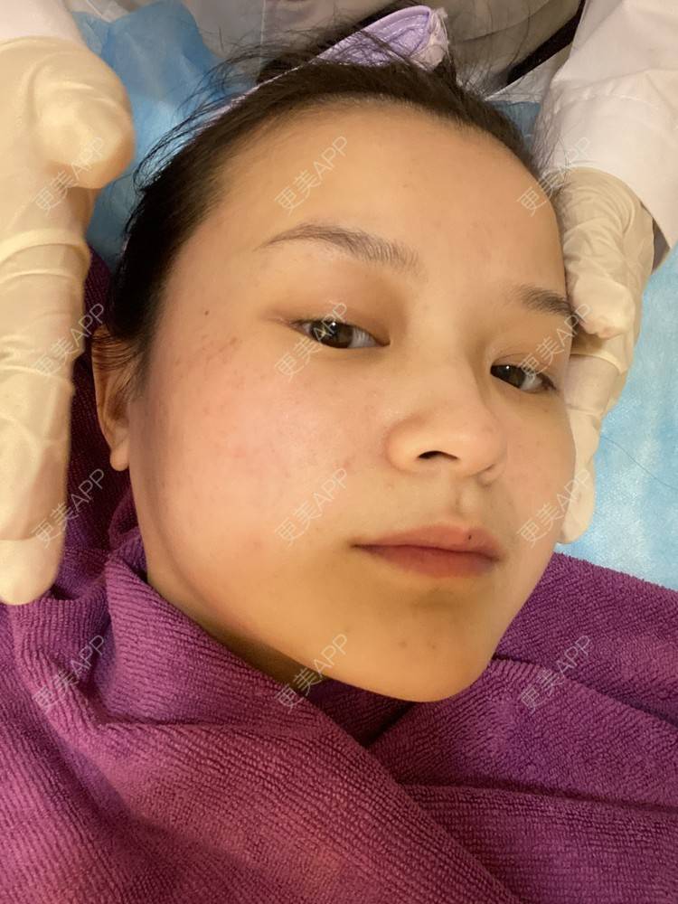 更美 - 一白遮三丑丑丑的热拉提经验 | 上海 | 热拉提