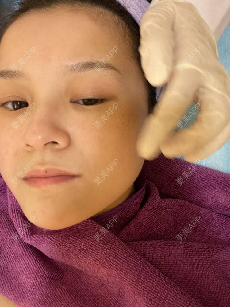 更美 - 一白遮三丑丑丑的热拉提经验 | 上海 | 热拉提