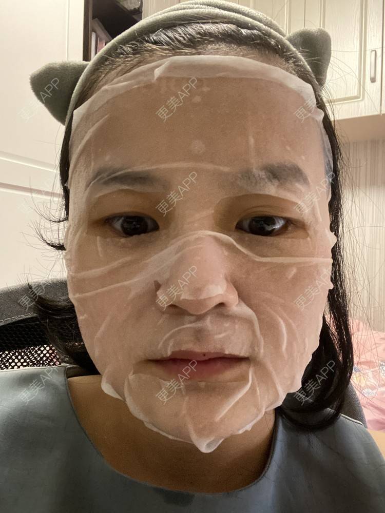 更美 - 一白遮三丑丑丑的热拉提经验 | 上海 | 热拉提