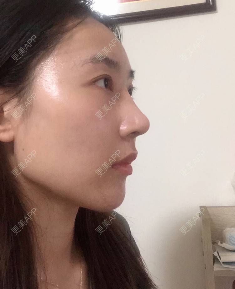 更美 - 会魔法的小仙女肛的鼻部多项经验 | 鼻部多项 | 河源