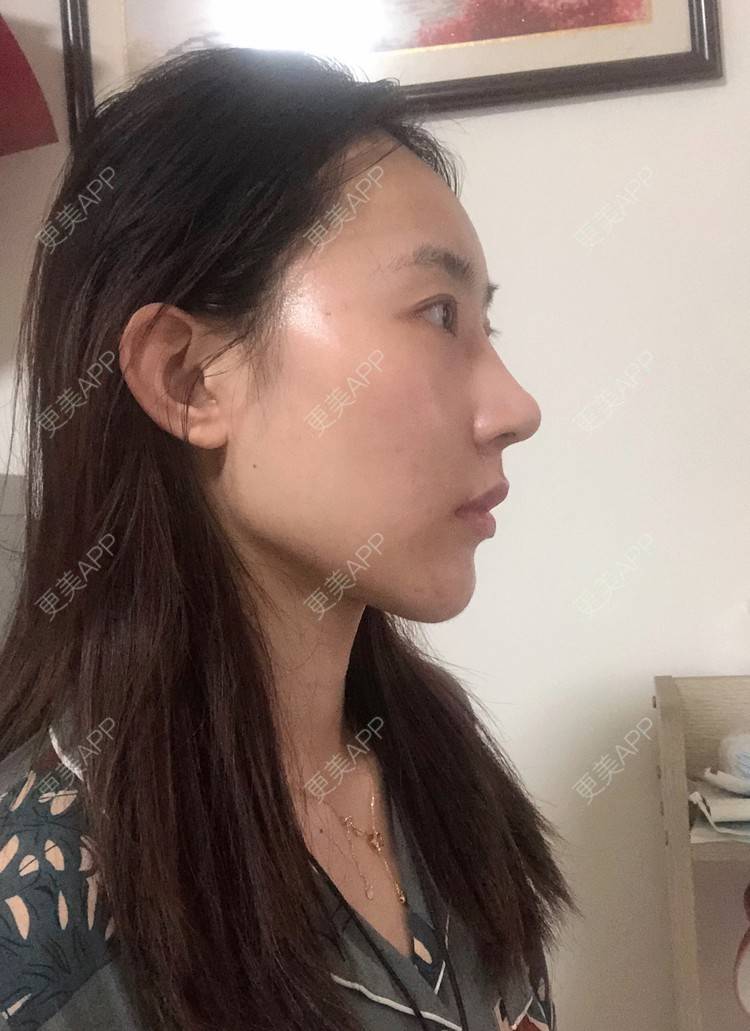 更美 - 会魔法的小仙女肛的鼻部多项经验 | 鼻部多项 | 河源