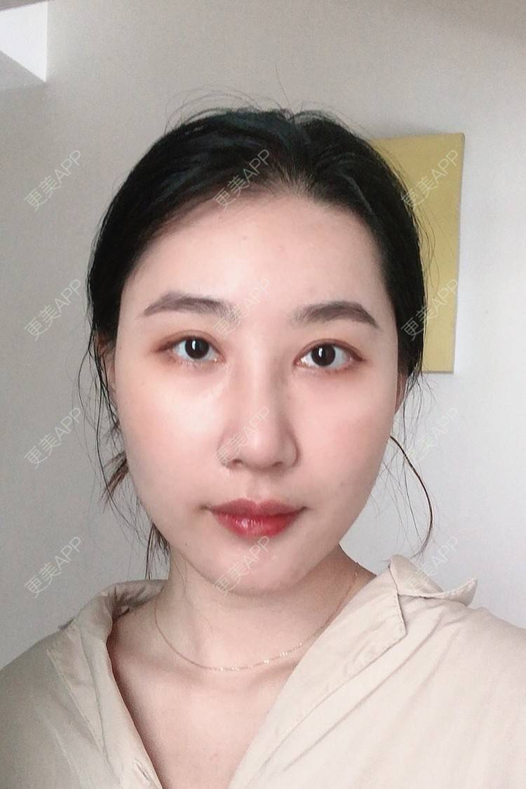 更美 - 会魔法的小仙女肛的鼻部多项经验 | 鼻部多项 | 河源