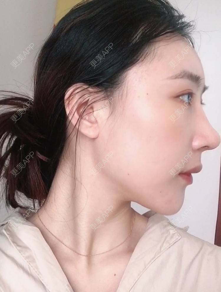 更美 - 会魔法的小仙女肛的鼻部多项经验 | 鼻部多项 | 河源