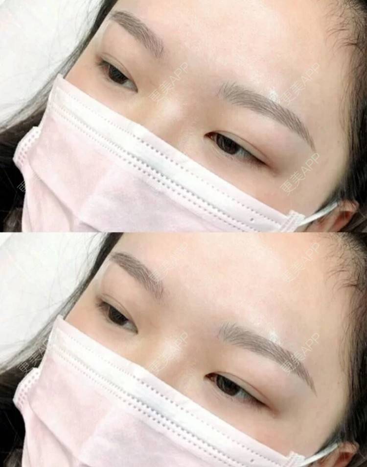 更美 - ┇醉yＩη前丗酒┆辗的半永久纹眉经验 | 半永久纹眉 | 北京