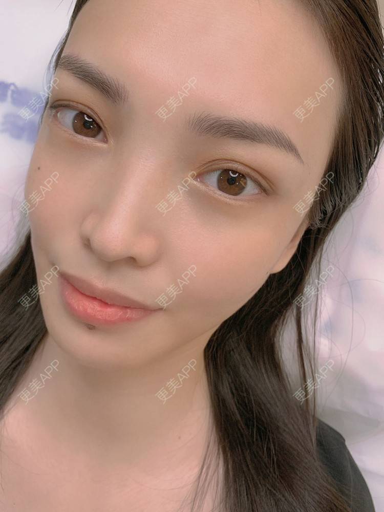 更美 - 秋南枝藤的半永久纹眉经验 | 半永久纹眉 | 北京