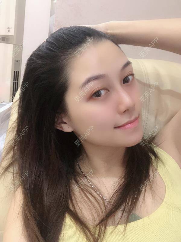 更美 - 贝勒爷贝贝的全脸整形套餐经验 | 全脸整形套餐 | V脸套餐 | 北京