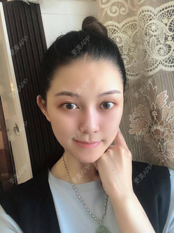 更美 - 贝勒爷贝贝的全脸整形套餐经验 | 全脸整形套餐 | V脸套餐 | 北京