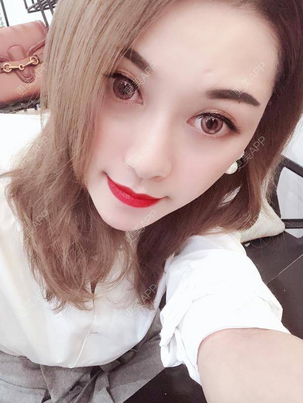 更美 - 贝勒爷贝贝的全脸整形套餐经验 | 全脸整形套餐 | V脸套餐 | 北京