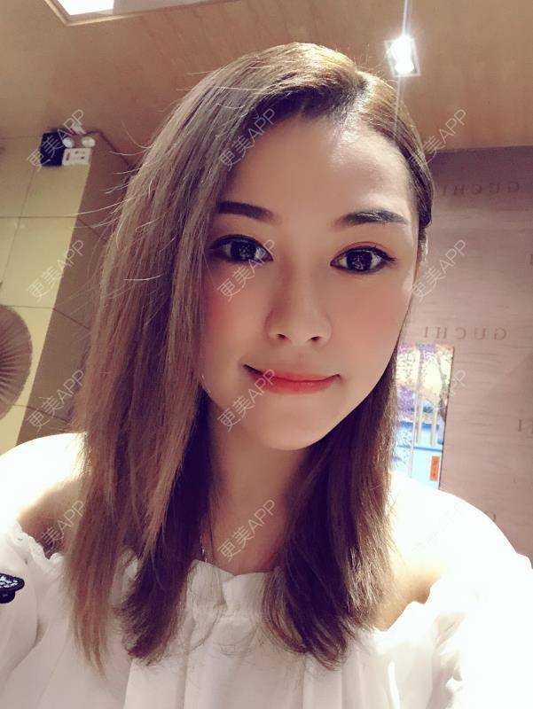 更美 - 贝勒爷贝贝的全脸整形套餐经验 | 全脸整形套餐 | V脸套餐 | 北京