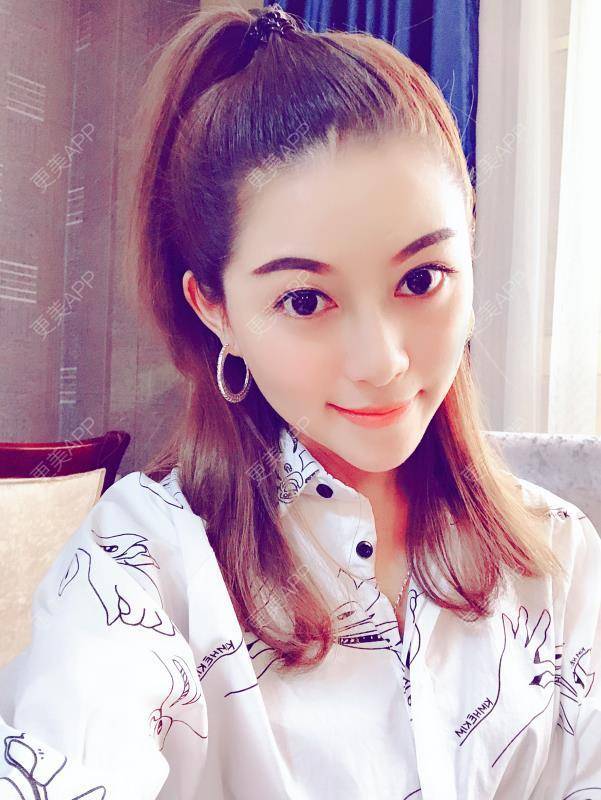 更美 - 贝勒爷贝贝的全脸整形套餐经验 | 全脸整形套餐 | V脸套餐 | 北京