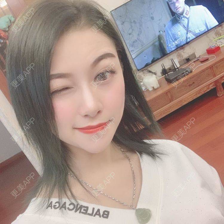 更美 - 贝勒爷贝贝的全脸整形套餐经验 | 全脸整形套餐 | V脸套餐 | 北京