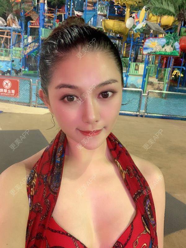 更美 - 贝勒爷贝贝的全脸整形套餐经验 | 全脸整形套餐 | V脸套餐 | 北京