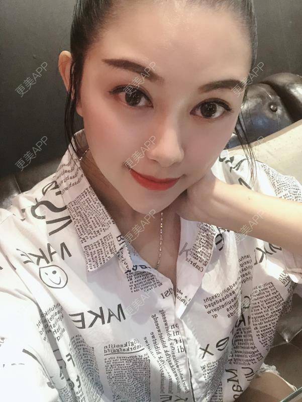 更美 - 贝勒爷贝贝的全脸整形套餐经验 | 全脸整形套餐 | V脸套餐 | 北京