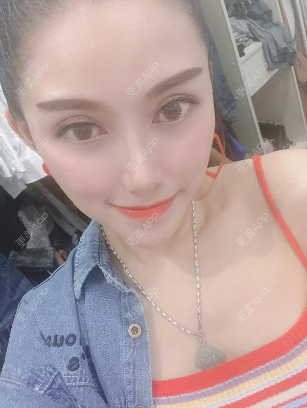 更美 - 贝勒爷贝贝的全脸整形套餐经验 | 全脸整形套餐 | V脸套餐 | 北京