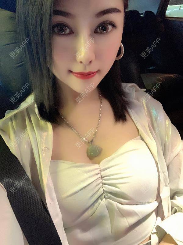 更美 - 贝勒爷贝贝的全脸整形套餐经验 | 全脸整形套餐 | V脸套餐 | 北京