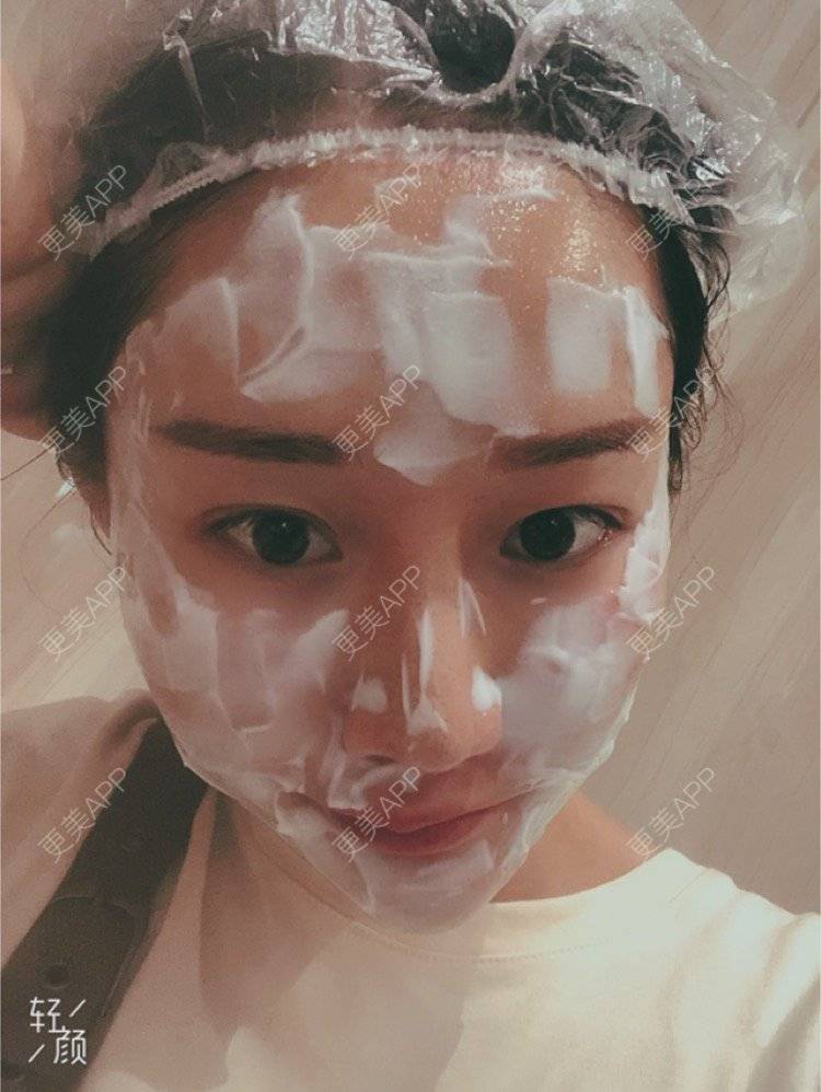 更美 - 更美用户KypVf5ovVE的点阵激光经验 | 上海 | 点阵激光
