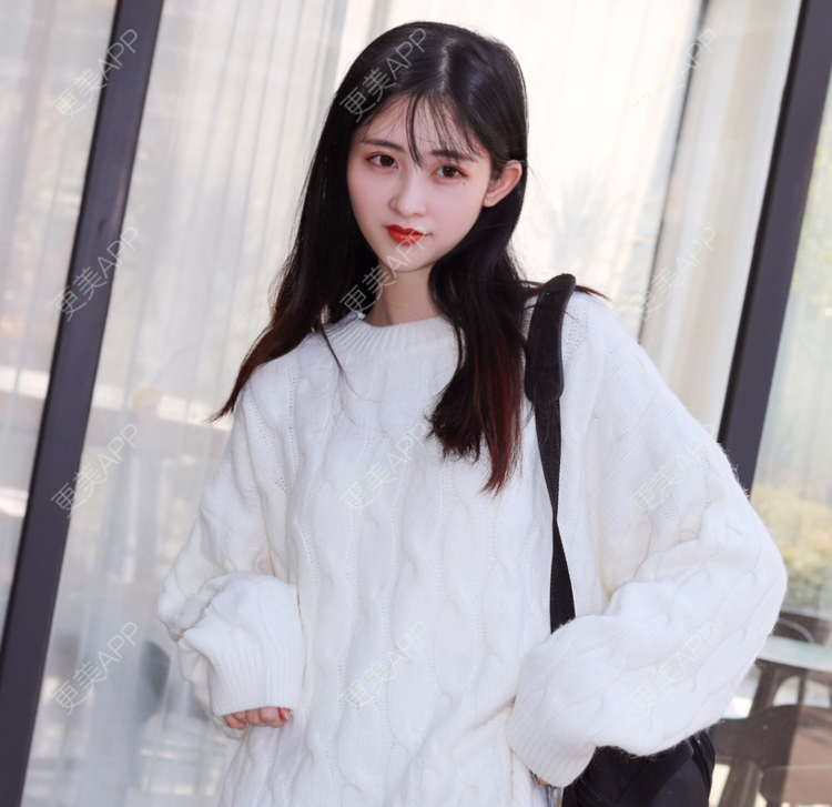 更美 - 更美用户Jy8A7mKou3的自体脂肪垫下巴经验 | 自体脂肪垫下巴 | 硅胶垫下巴 | 膨体垫下巴 | 人工骨垫下巴 | V脸套餐 | 广州