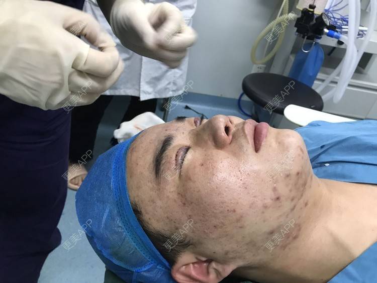 更美 - 更美用户icRJAuFJQH的膨体隆鼻经验 | 膨体隆鼻 | 郑州