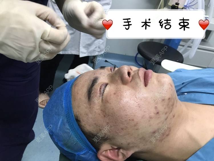 更美 - 更美用户icRJAuFJQH的膨体隆鼻经验 | 膨体隆鼻 | 郑州