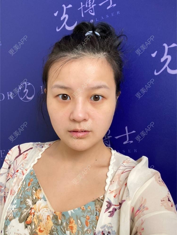 更美 - 一白遮三丑丑丑的热拉提经验 | 上海 | 热拉提