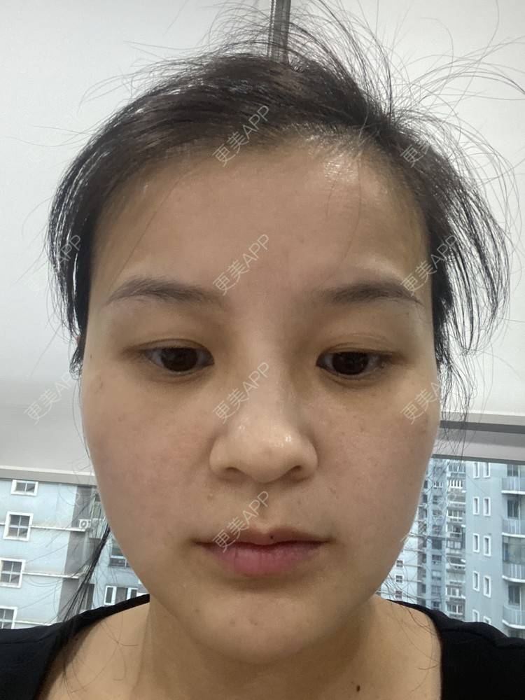 更美 - 一白遮三丑丑丑的热拉提经验 | 上海 | 热拉提