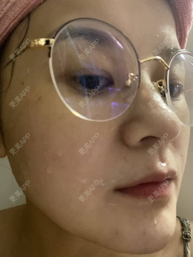 更美 - 一白遮三丑丑丑的热拉提经验 | 上海 | 热拉提