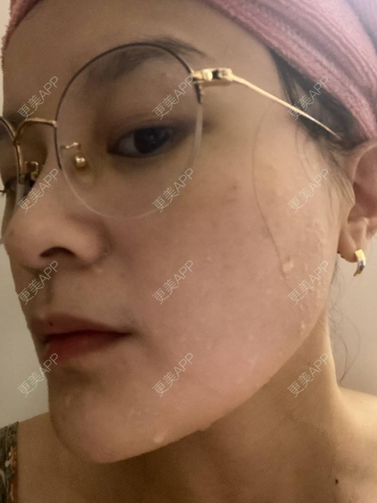 更美 - 一白遮三丑丑丑的热拉提经验 | 上海 | 热拉提